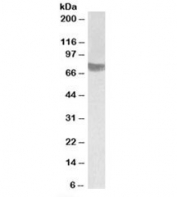 Western blot testing of human skeletal muscle lysate with TRC8 antibody at 1ug/ml. Predicted/observed molecular weight: ~75kDa.