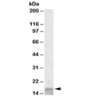 Western blot testing of human skeletal muscle lysate with SCOC antibody at 0.1ug/ml. Predicted molecular weight: ~11-18kDa (isoforms 1-6).