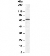 Western blot testing of rat brain lysate with Cannabinoid Receptor antibody at 0.1ug/ml. Predicted molecular weight ~53 kDa, can also be observed at ~70kDa.