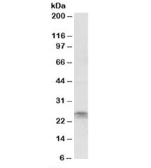 Western blot testing of Jurkat lysate with FGF8 antibody at 2ug/ml. Predicted molecular weight: ~25kDa.
