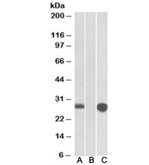Western blot of HEK293 lysate overexpressing human MID1IP1-MYC probed with MID1IP1 antibody [1ug/ml] in lane A and anti-MYC in lane C. Mock-transfected HEK293 probed with MID1IP1 antibody [1ug/ml] in lane B. Predicted molecular weight: ~20kDa but routinely observed at ~28kDa.