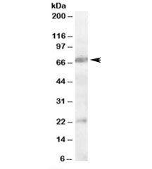 Western blot testing of rat brain lysate with CHRNA4 antibody at 0.3ug/ml. Predicted/observed molecular weight: ~70kDa. Both observed bands are blocked by addition of immunizing peptide.