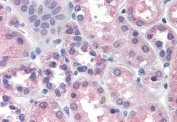 IHC testing of FFPE human kidney tissue with PCK1 antibody at 2ug/ml. HIER: steamed with pH6 citrate buffer, AP-staining.