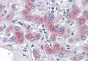 IHC testing of FFPE human liver tissue with PCK1 antibody at 2ug/ml. HIER: steamed with pH6 citrate buffer, AP-staining.