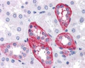 IHC testing of FFPE human kidney tissue with APH1A antibody at 5ug/ml. Required HIER: steamed antigen retrieval with pH6 citrate buffer; AP-staining.