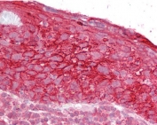 IHC testing of FFPE human tonsil tissue with TROP2 antibody at 2.5ug/ml. Required HIER: steamed antigen retrieval with pH6 citrate buffer; AP-staining.