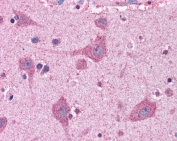 IHC testing of FFPE human cortex (brain) tissue with ACSL4 antibody at 3.75ug/ml. Required HIER: steamed antigen retrieval with pH6 citrate buffer; AP-staining.