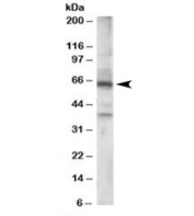 Western blot testing of Jurkat lysate with RGS14 antibody at 0.5ug/ml. Predicted molecular weight: ~65kDa.