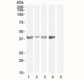Western blot testing of Asponrin antibody with lysate from 1) human tonsil (Ab at 1ug/ml), 2) human uterus (Ab at 0.3ug/ml), 3) mouse skeletal muscle (Ab at 0.3ug/ml), 4) rat skeletal muscle (Ab at 1ug/ml) and 5) human cerebellum (negative control, Ab at 1ug/ml). Predicted molecular weight ~40 kDa.~