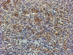 IHC staining of FFPE human tonsil with MyD88 antibody at 4ug/ml. HIER: steamed with pH9 Tris/EDTA buffer, HRP-staining. pH6 antigen retireval is not sufficient.
