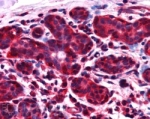 IHC staining of FFPE human breast with ALS2CR1 antibody at 2.5ug/ml. HIER: steamed with pH6 citrate buffer, AP-staining.