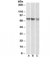 Western blot of human A) HepG2, B) K562 and C) HeLa cell lysate (nuclear fractions)  with ATF2 antibody at 1ug/ml. Expected molecular weight: 65-70 kDa.
