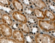 IHC testing of FFPE human kidney with RNF34 antibody at 4ug/ml. HIER: steamed with pH9 Tris/EDTA buffer, HRP-staining.