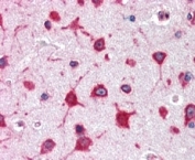 IHC staining of FFPE human cerebral cortex with RPL8 antibody at 2.5ug/ml. HIER: steamed with pH6 citrate buffer, AP-staining.