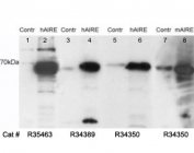 Western blot testing of HEK293 cell lysates with AIRE antibody at 0.05ug/ml;  untransfected (Lanes 5 and 7) and transfected with human AIRE (lane 6) or mouse AIRE (lane 7). Predicted molecular weight: ~58kDa.