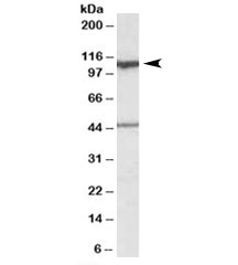 Western blot testing of human cerebellum lysate with COG1 antibody at 0.1ug/ml. The expected ~110kDa band and the additional ~45kDa band are both blocked by the immunizing peptide.