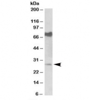 Western blot testing of mouse heart lysate with Nmnat3 antibody at 0.5ug/ml. Predicted/observed molecular weight: ~28kDa. Both observed bands are blocked by addition of immunizing peptide.