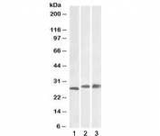 Western blot testing of liver lysate from 1) mouse, 2) rat and 3) pig using PGAM1 antibody at 0.03ug/ml. Predicted molecular weight: ~28kDa.