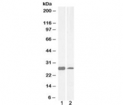 Western blot testing of human 1) cerebellum and 2) liver lysate and PGAM1 antibody at 0.03ug/ml. Predicted molecular weight: ~28kDa.