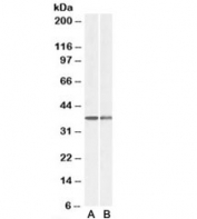 Western blot of mouse (A) and rat spleen (B) lysates with CAPG antibody at 0.1ug/ml. Predicted molecular weight: ~38kDa.