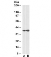 Western blot testing of peripheral blood lymphocyte lysate with CAPG antibody at 0.3ug/ml (Lane A: cat # R34825 and Lane B: cat # 34356). Predicted molecular weight: ~38kDa.