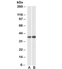 Western blot testing of peripheral blood lymphocyte lysate with CAPG antibody at 0.3ug/ml (Lane A: cat # <a href=../tds/capg-antibody-r34825>R34825</a> and Lane B: cat # 34356). Predicted molecular weight: ~38kDa.