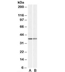 Western blot of mouse (A) and rat spleen (B) lysates with CAPG antibody at 0.1ug/ml. Predicted molecular weight: ~38kDa.