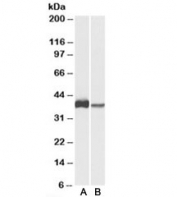 Western blot testing of U937 [A] and human spleen [B] lysates with CAPG antibody at 0.3ug/ml. Predicted molecular weight: ~38kDa.