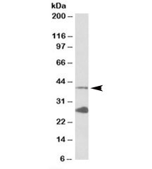 Western blot testing of K562 lysate with UROD antibody at 0.1ug/ml. The expected ~40kDa band and the additional ~28kDa band are both blocked by the immunizing peptide.