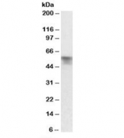 Western blot testing of rat liver lysate with Serpina6 antibody at 0.03ug/ml. Predicted molecular weight: ~45/50-60kDa (unmodified/glycosylated).