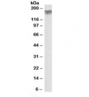 Western blot testing of human frontal cortex lysate with NCAM antibody at 0.01ug/ml. The glycosylated form is detected with a molecular weight of ~180 kDa.