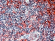IHC staining of FFPE human thymus with CADM4 antibody at 2.5ug/ml. HIER: steamed with pH6 citrate buffer, AP-staining.