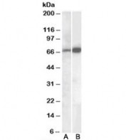 Western blot testing of human cerebellum lysate with CADM4 antibody A) cat # R34370 (0.1ug/ml) and B) cat # R35577 (0.05ug/ml). Predicted molecular weight: ~43/50-70kDa (unmodified/glycosylated)