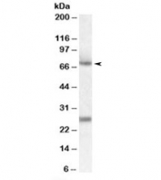 Western blot testing of human duodenum lysate with alpha-2-Antiplasmin antibody at 0.1ug/ml. Predicted molecular weight: ~55kDa/70 (unmodified/glycosylated). Both observed bands are blocked by the immunizing peptide.