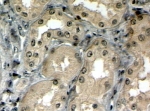 IHC staining of FFPE human kidney with ABCC5 antibody at 4ug/ml. HIER: steamed with pH6 citrate buffer, HRP-staining. Similar results with antigen retrieval at pH9.