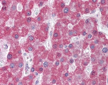 IHC testing of FFPE human liver tissue with ABCC5 antibody at 5ug/ml. Required HIER: steamed antigen retrieval with pH6 citrate buffer; AP-staining.