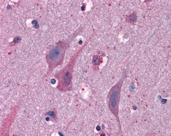 IHC testing of FFPE human cortex (brain) tissue with MYRIP antibody at 3.75ug/ml. Required HIER: steamed antigen retrieval with pH6 citrate buffer; AP-staining.