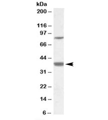 Western blot testing of frontal cortex lysate with LASS1 antibody at 1ug/ml. The expected ~37kDa band and the additional ~85kDa band are both blocked by the immunizing peptide.