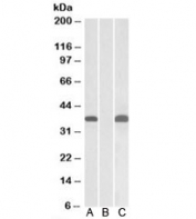 Western blot testing of HEK293 lysate overexpressing human PIM2-MYC with PIM2 antibody (0.1ug/ml) in Lane A and anti-MYC (1/1000) in lane C. Mock-transfected HEK293 probed with PIM2 (0.1ug/ml) in Lane B. Predicted molecular weight: ~34kDa