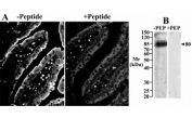 A) IHC staining of cryosections of rat small intestines with Slc5a1 antibody at 25ug/ml. Detection by CY3 fluorescence.  B) Western blot of brush-border membranes from rat small intestines with Slc5a1 antibody at 2.5ug/ml.