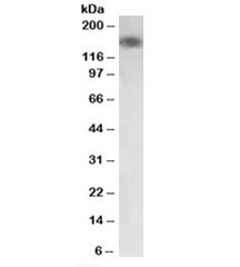 Western blot testing of human colon lysate with MYLK antibody at 0.03ug/ml. Predicted molecular weight: ~197kDa, observed here at ~150kDa.
