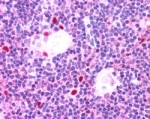 IHC staining of FFPE human thymus with AIRE antibody at 2.5ug/ml. HIER: steamed with pH6 citrate buffer, AP-staining.