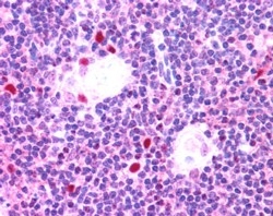 IHC staining of FFPE human thymus with AIRE antibody at 2.5ug