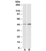 Western blot of mouse (A) and rat (B) brain lysates with NDRG2 antibody at 0.3ug/ml. Predicted molecular weight: ~41kDa.