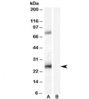 Western blot testing of A431 lysate with EBAG9 antibody at 0.2ug/ml with [B] and without [A] blocking/immunizing peptide. Predicted molecular weight: ~25/29-34 kDa (isoform 1/2).