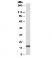 Western blot testing of human colorectal cancer lysate with RPL23 antibody at 0.1ug/ml. Predicted molecular weight: ~15kDa.