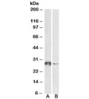 Western blot testing of human liver [A] and peripheral blood lymphocyte [B] lysates with GSTO1 antibody at 0.5ug/ml. Predicted molecular weight: ~28kDa.