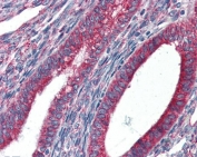 IHC staining of FFPE human uterus with GPR94 antibody at 5ug/ml. HIER: steamed with pH6 citrate buffer, AP-staining.