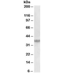 Western blot testing of human prostate lysate with Clusterin antibody at 0.03ug/ml. Predicted molecular weight: ~75kDa (heterodimer precursor), 36-39kDa (alpha subunit), 34-36kDa (beta subunit).