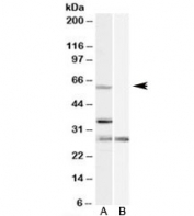 Western blot testing of HeLa cell lysate with PRPF31 antibody at 1ug/ml with [B] and without [A] blocking/immunizing peptide. Predicted molecular weight: ~55kDa.